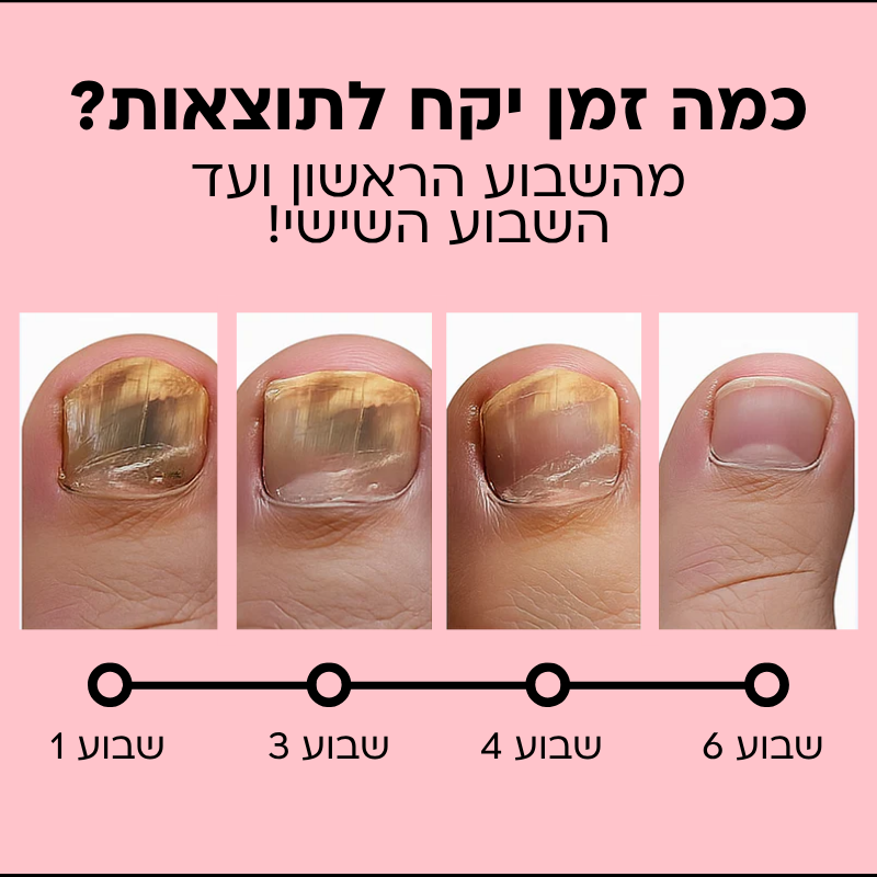 מדבקות לשיקום הציפורניים