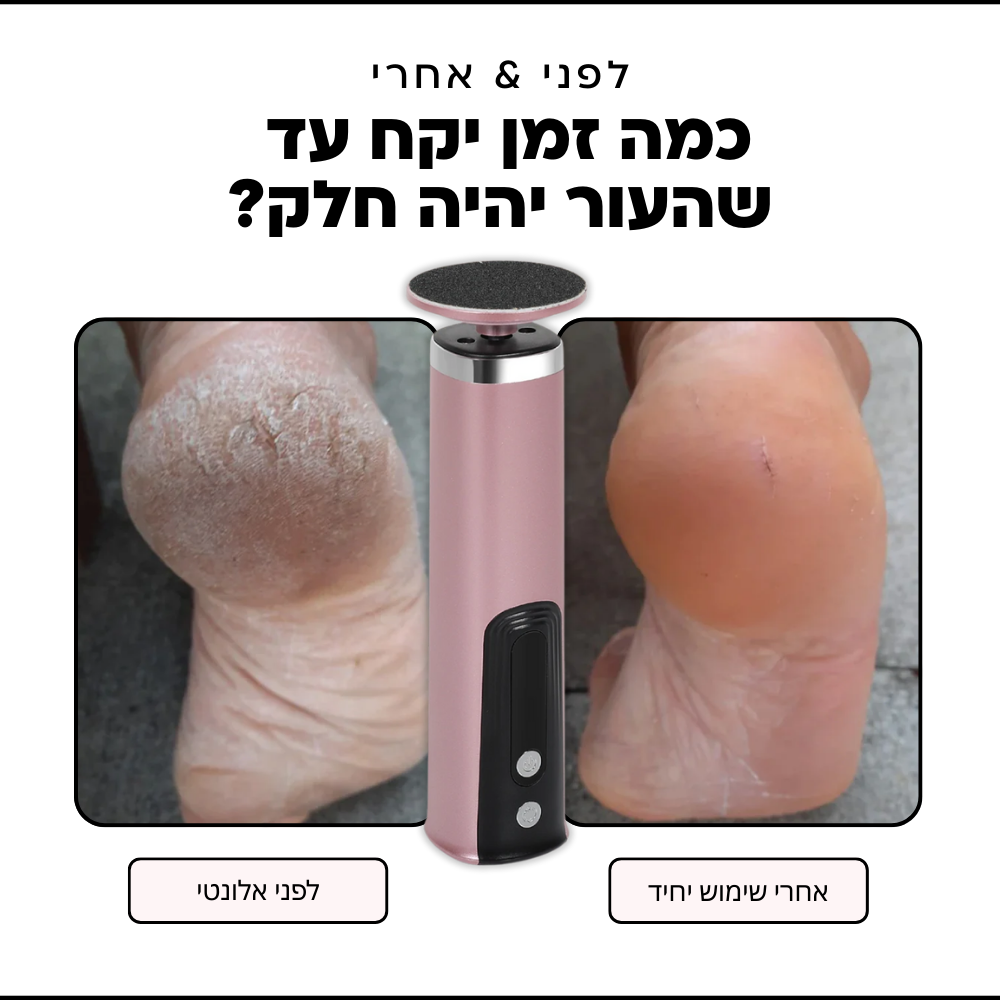 מארז הפדיקור של אלונטי