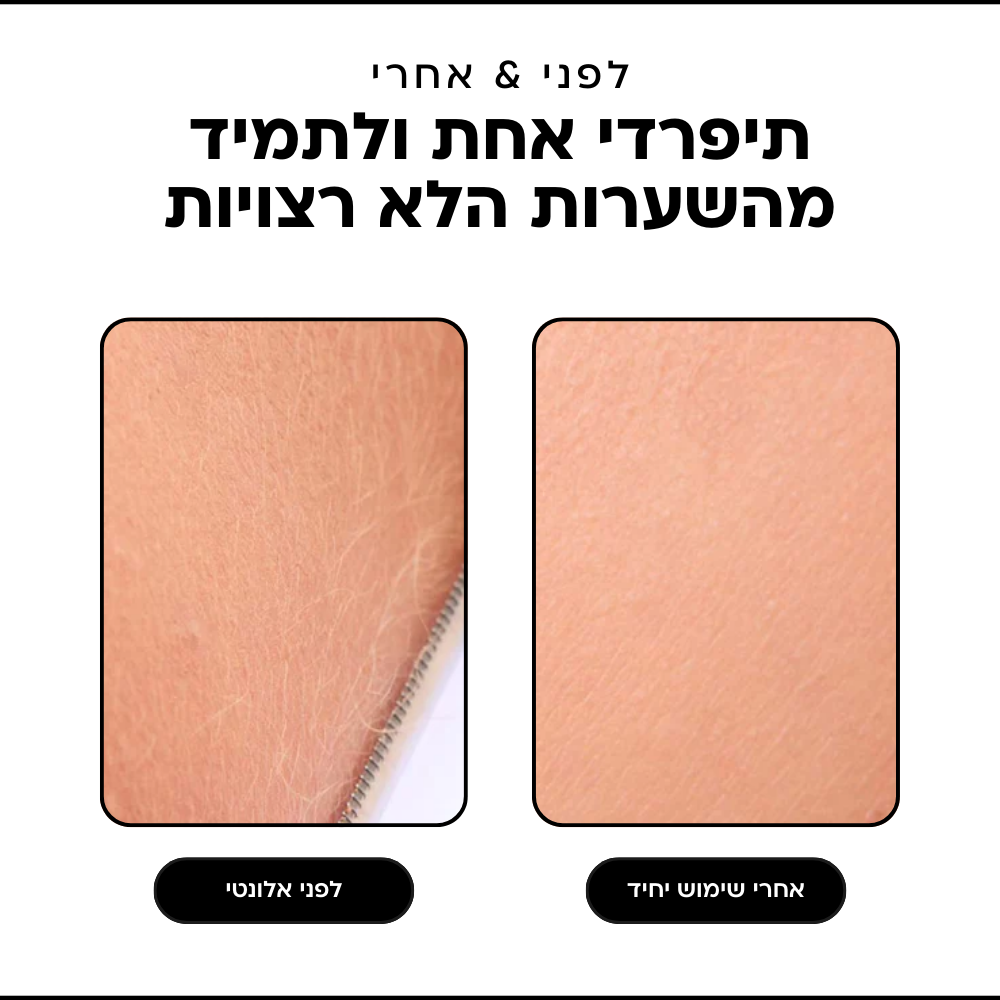 SonicPro - מכשיר בייתי להסרת השיער בפנים