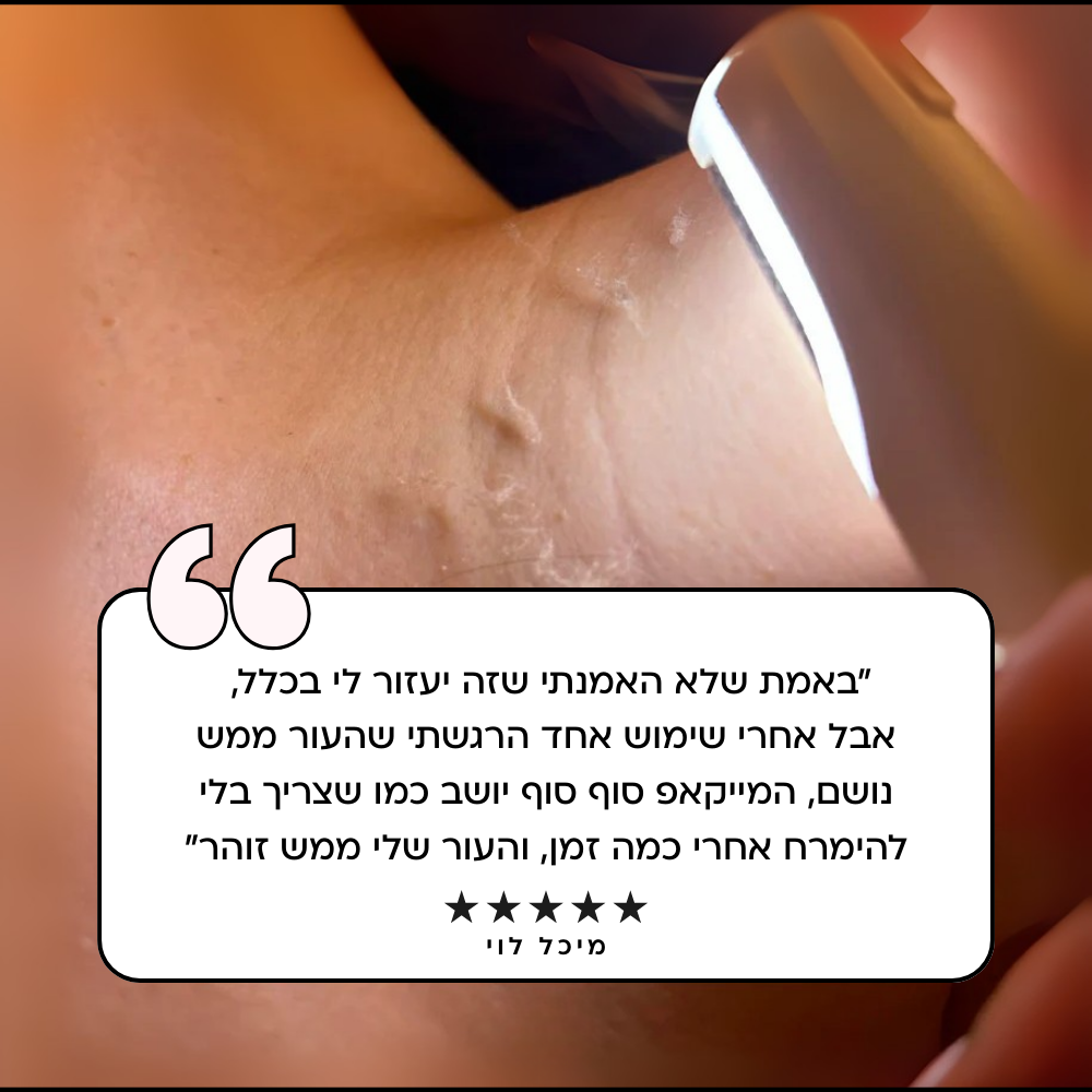 SonicPro - מכשיר בייתי להסרת השיער בפנים